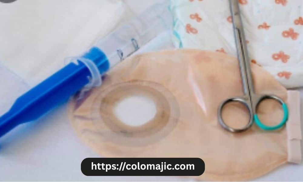 Ostomy Supplies for Different Lifestyles: What Works Best