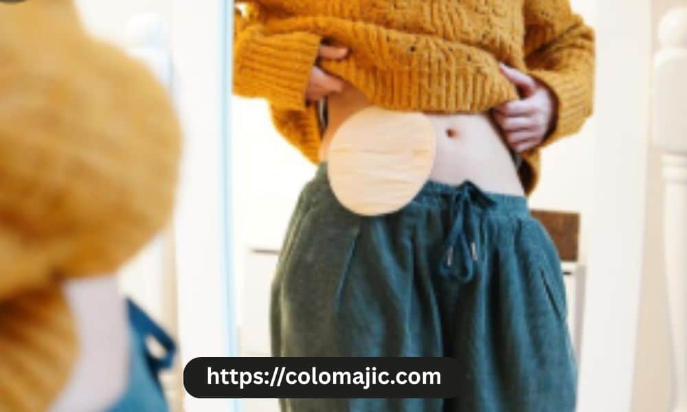 Which Ostomy Bag is Best for You After Surgery?